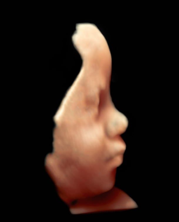 Scanning