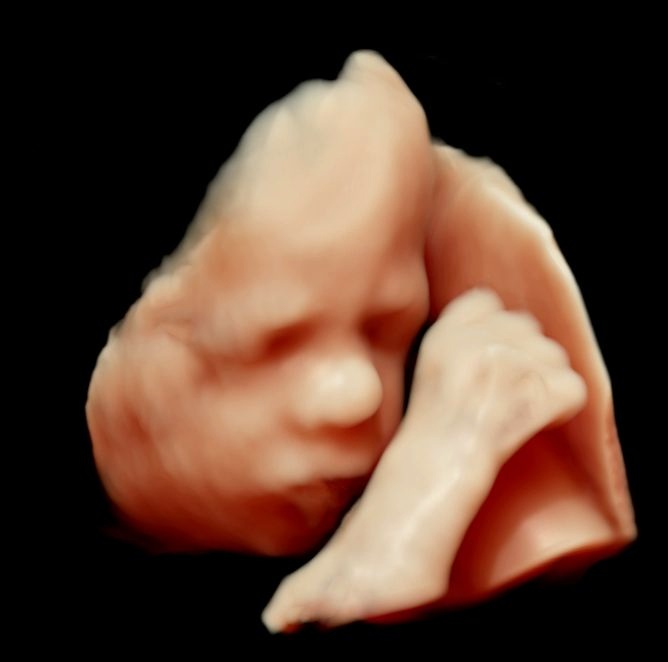 Scanning