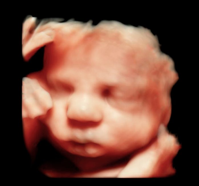 Scanning