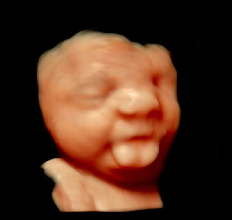 Scanning
